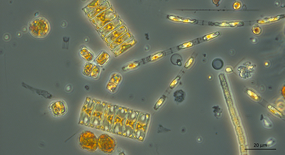 Kasviplanktonsoluja kevätnäytteessä_500xsuurennus_Sirpa Lehtinen_556x303px.jpg